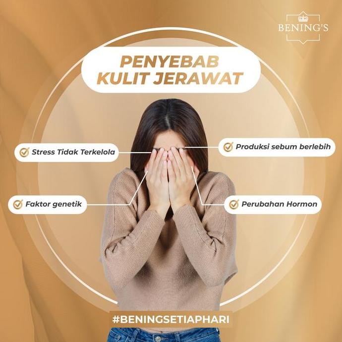 Grosir Bening'S Acne Day Cream Teen Series Remaja