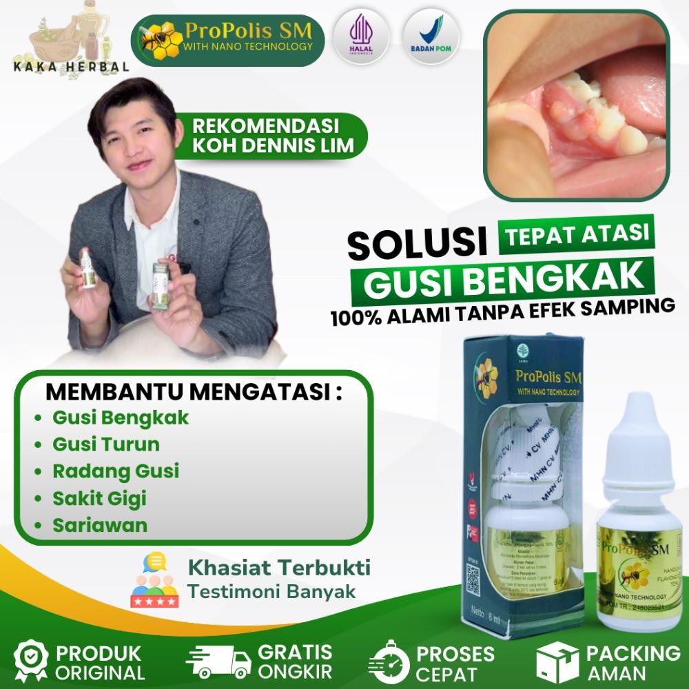 CHRIS KAKA HERBAL - OBAT GUSI BENGKAK DAN SAKIT GIGI, OBAT GIGI BERLUBANG, OBAT GUSI TURUN, OBAT RAD