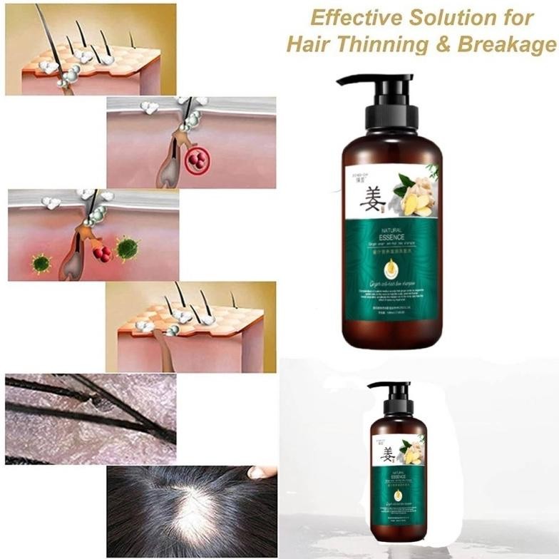 Spesial Promo/ Cod OriZhenxiu Shampo Penumbuh Rambut Cepat / Ginger Shampoo / Shampo Anti Rontok / A