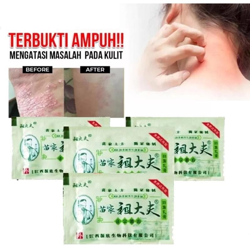 Ls Sachet Zudaifu Salep Kulit Gatal Menghilangkan Jerawat Kulit Eksim 2Gr