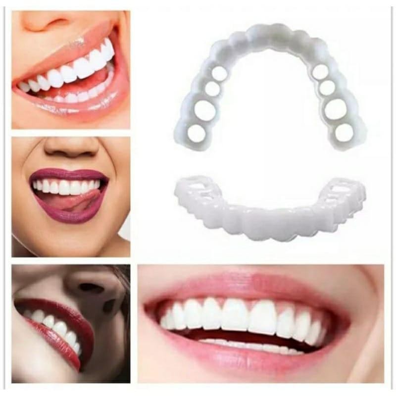 Snap On Smile 100% Original Autenthic Perawatan Kesehatan Pemutih Gigi Palsu Renggang  Snap On Smile