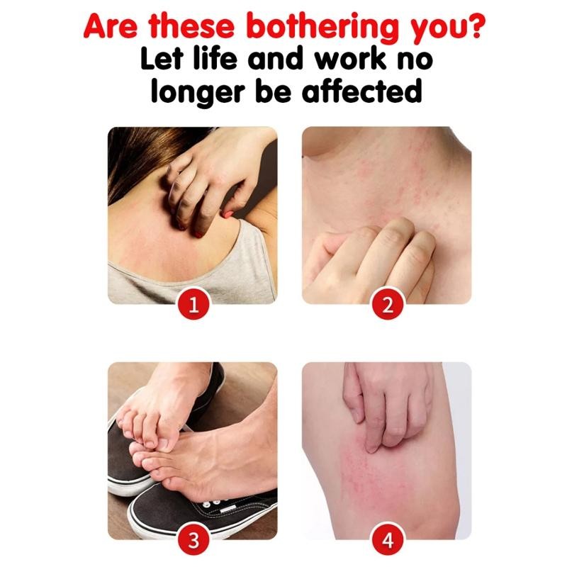 Salep Gatal Paling Ampuh 30Gr Salep Gatal Obat Gatal Selangkangan Obat Selangkangan Gatal Dan Hitam 