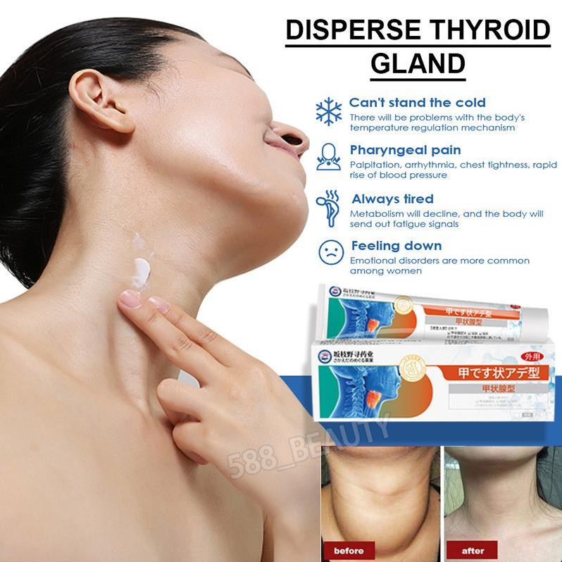 Premium Salep Herbal Tiroid 20G / Krim Tiroid / Obat Gondok Kelenjar / Tiroid Benjolan Di Leher Kist