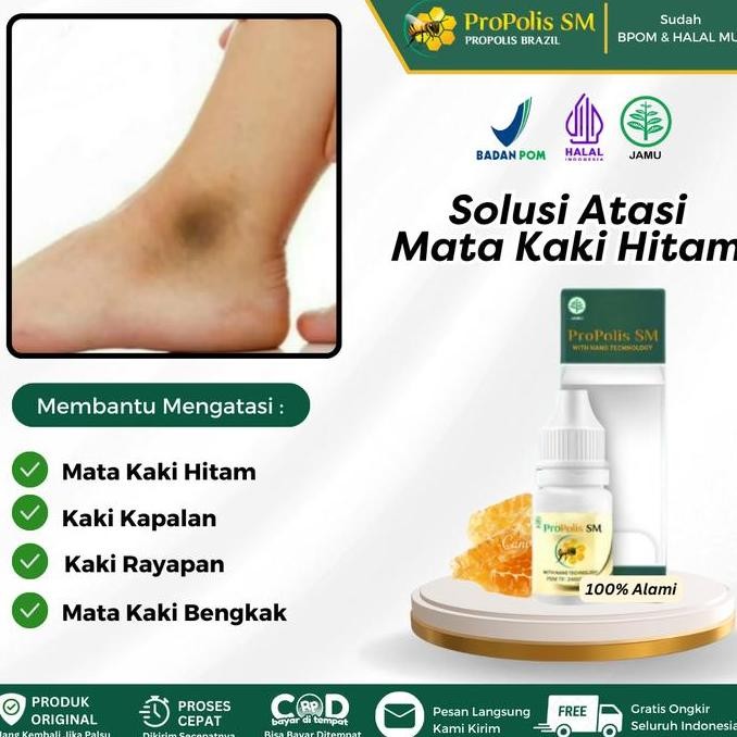 Sale Propolis Sm Salep Oles Untuk Mata Kaki Hitam, Pemutih Mata Kaki Hitam, Mata Kaki Hitam Dan Kasa