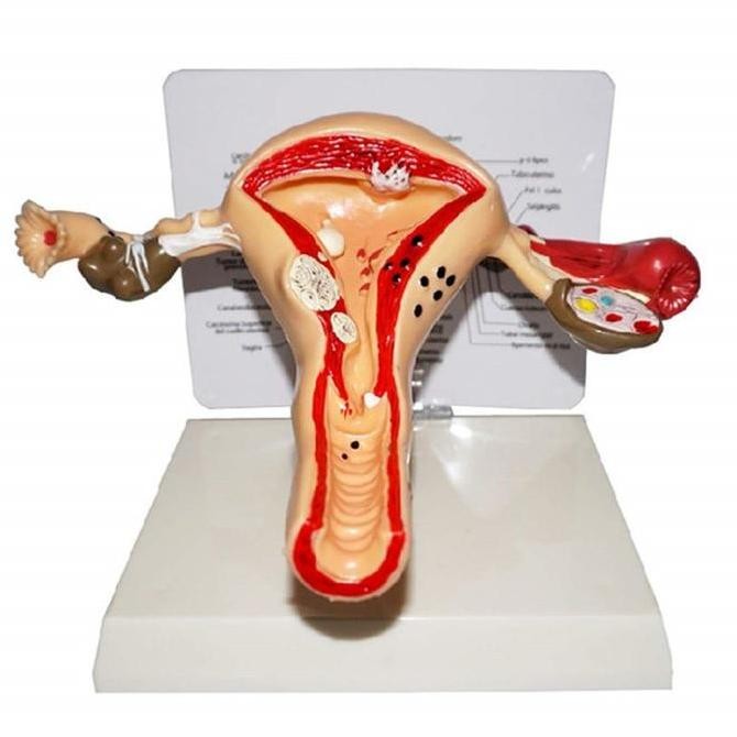 

Uterus Ovary Anatomical Model Anatomy Alat Peraga Anatomi Model Patologis Uterus Ovarium Manekin Rahim Kualitas Original