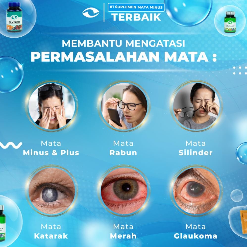 Smart Vision Suplemen Mata Minus, Plus, & Silinder Terbaik - S-Vision Ready