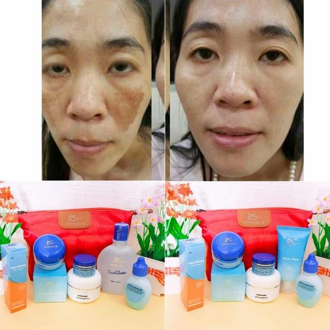 BEBAS ONGKIR - Paket Flek Hitam skincare dr supijati
