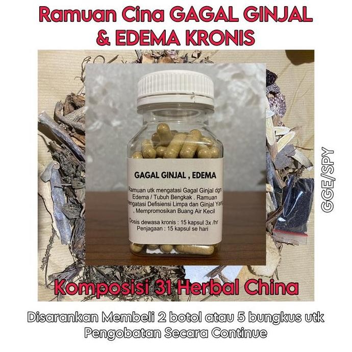 TERBARU - Obat Sinshe Cina GAGAL GINJAL KRONIS dan EDEMA/BENGKAK KRONIS