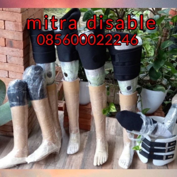 TERJAMIN kaki palsu atas lutut (lokal) telapak import