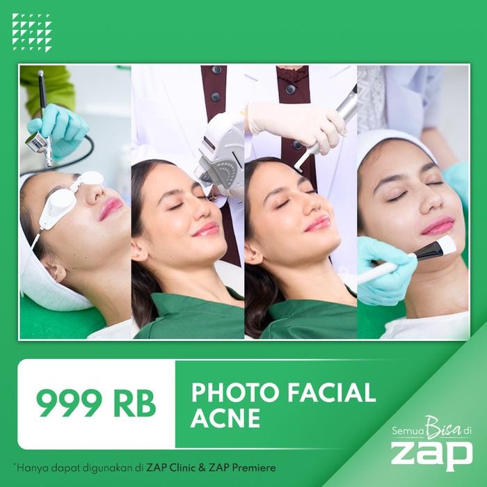 Zap Clinic Photo Facial Acne Terlaris