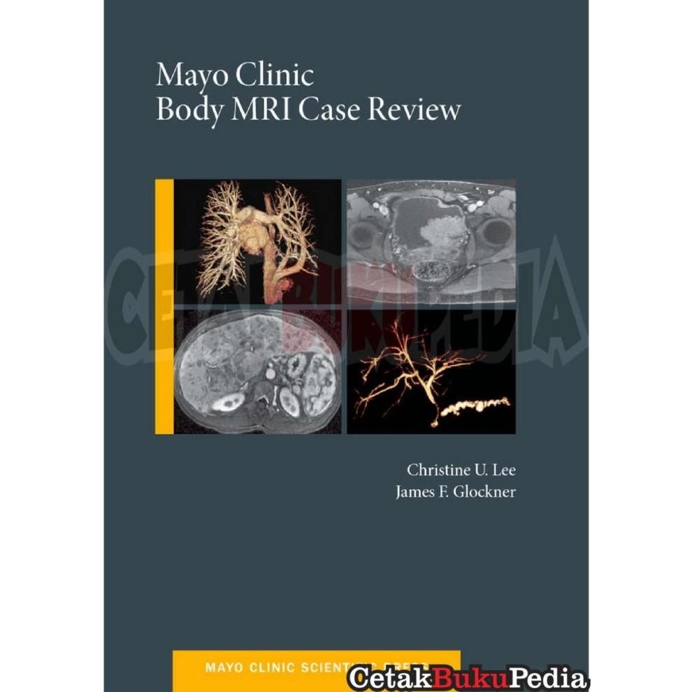 

Book Mayo Clinic Body Mri Case Review Softcover