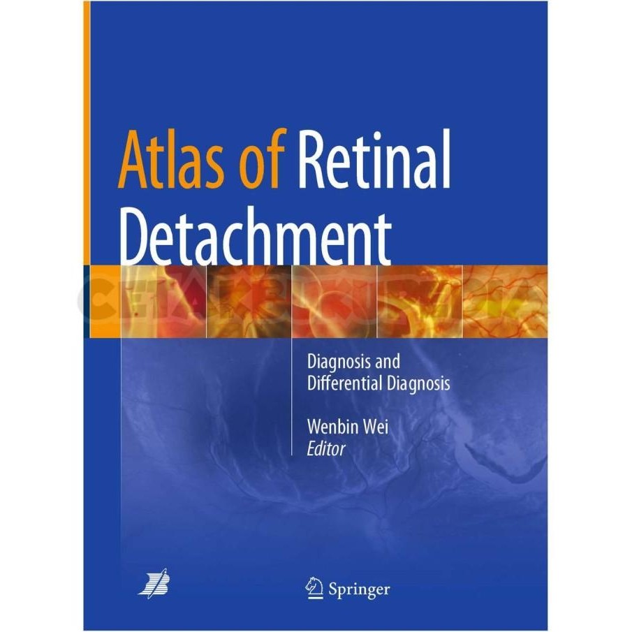 Atlas Of Retinal Detachment Diagnosis Differential Diagnosis Softcover