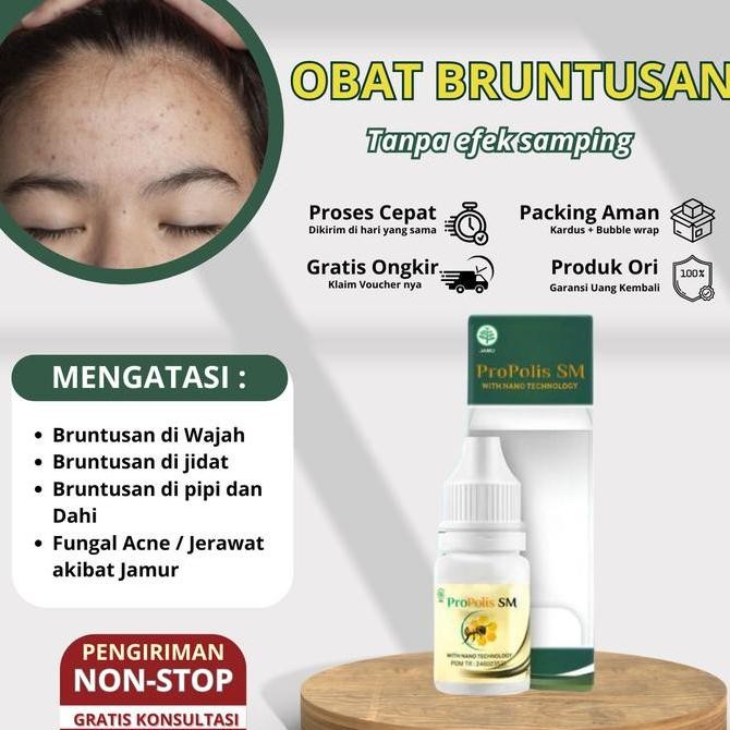 Murah Jerawat Pasir Bruntusan Herbal Penghilang Bruntusan Kecil Di Muka Tetes Penghilang Beruntusan 