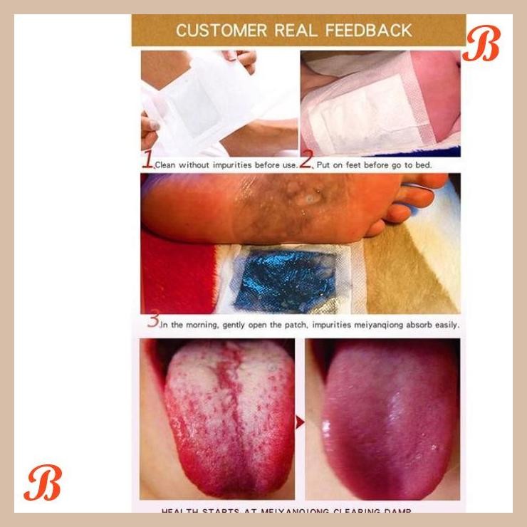 [CBM] KOYO KAKI DETOX FOOT PATCH FOOT PATCH HERBAL BAU FOOT PATCH 50PCS