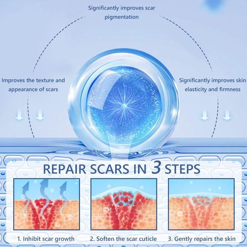 Scar Remover Cream Penghilang Bekas Luka Koreng Scar Remover Cream Obat Penghilang Bekas Luka Lama H