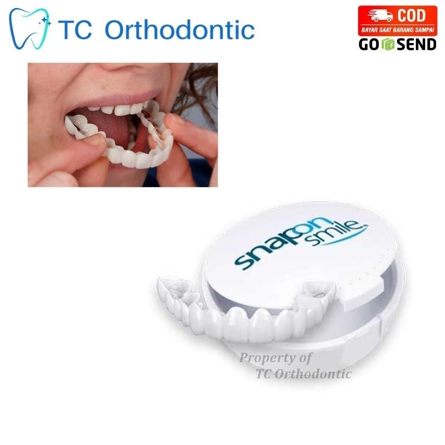 Snap On Smile Gigi Palsu Atas Bawah Pria Wanita Snap On Smile Veneers Gigi Perfect Smile Gigi Tiruan