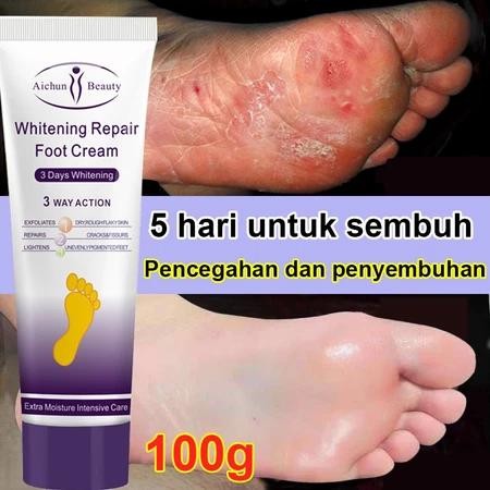 Salep Kaki Pecah2 Paling Ampuh Obat Kaki Pecah Pelembab Kaki  Kering Dan Pecah Perawatan Kaki Penghi