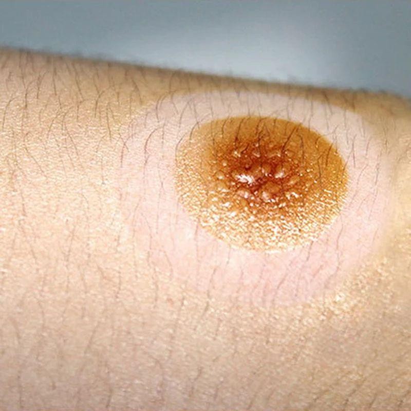 50Pcs Moxa Stick+Moksa Tempel Moksa Tanpa Asap Utk Akupunktur Dan Moksibusi Tongkat Moxa Terapi Moks