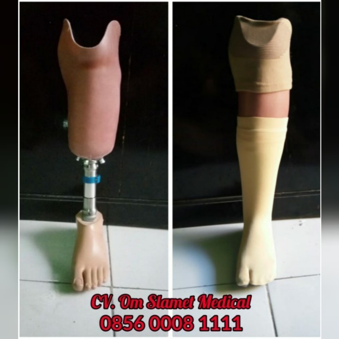 OBRAL kaki palsu bawah lutut ( carbon ) import telapak single axis import