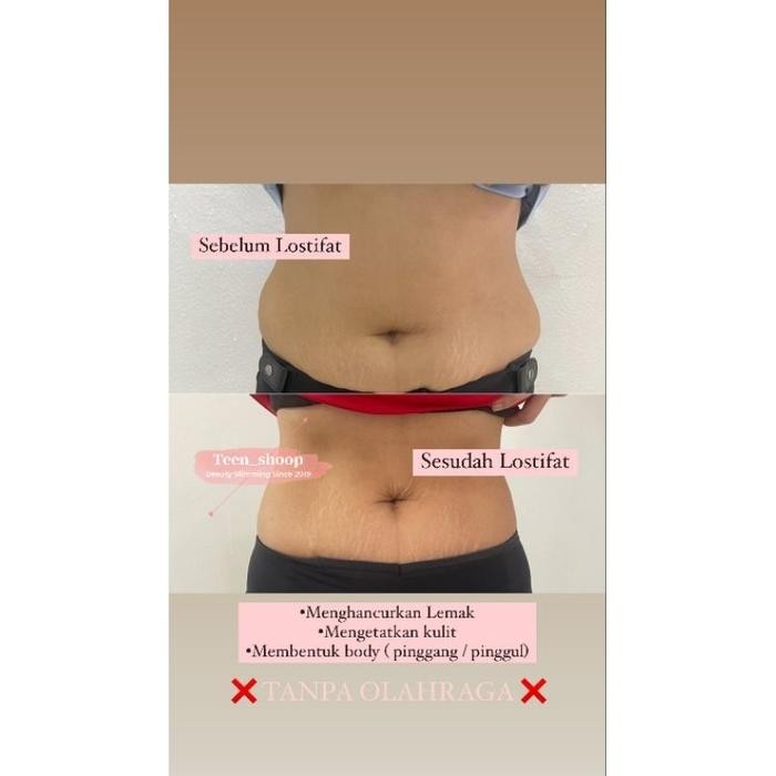BISA GOSEND! Lostifat Triple Strong Slimming Pen lostifat