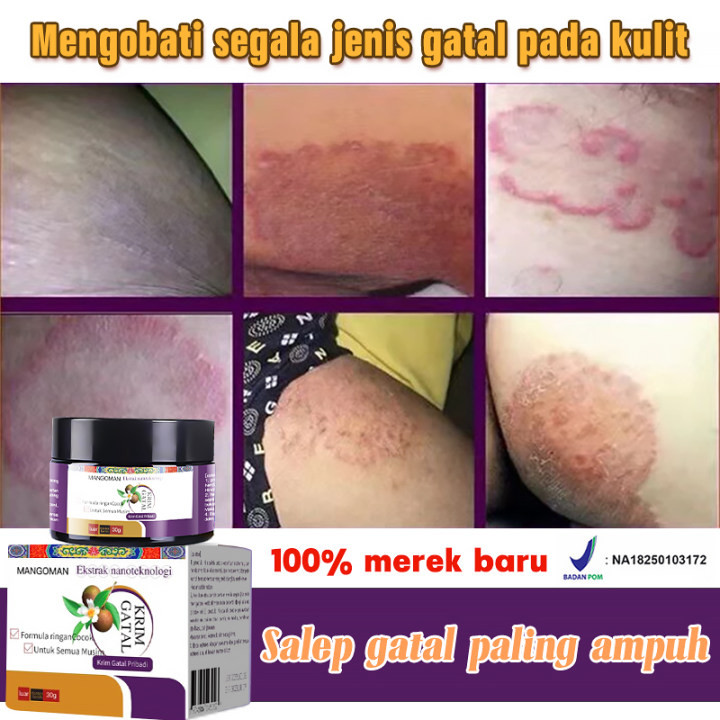 【BPOM Terdaftar】Salep Antijamur Pereda Gatal Selangkangan, Menghilangkan Gatal, Selangkangan Menghit