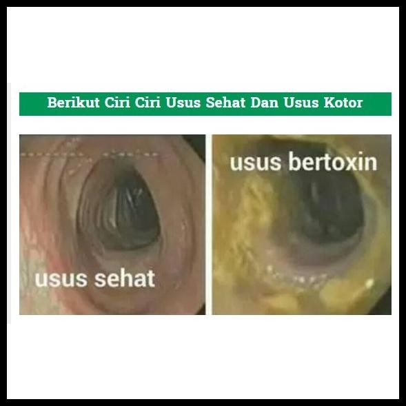 

Original Senna Leaf Annafis Superfood 250Gr | Daun Senna Membersihkan Usus | Detox Usus Original Best Seller