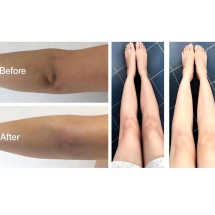 Sale Nei Peeling Spray Penghilang Daki 90 Ml