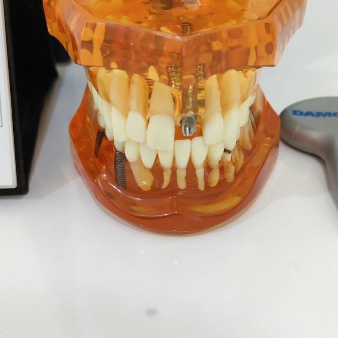 Perawatan Ortodonti Kontrol