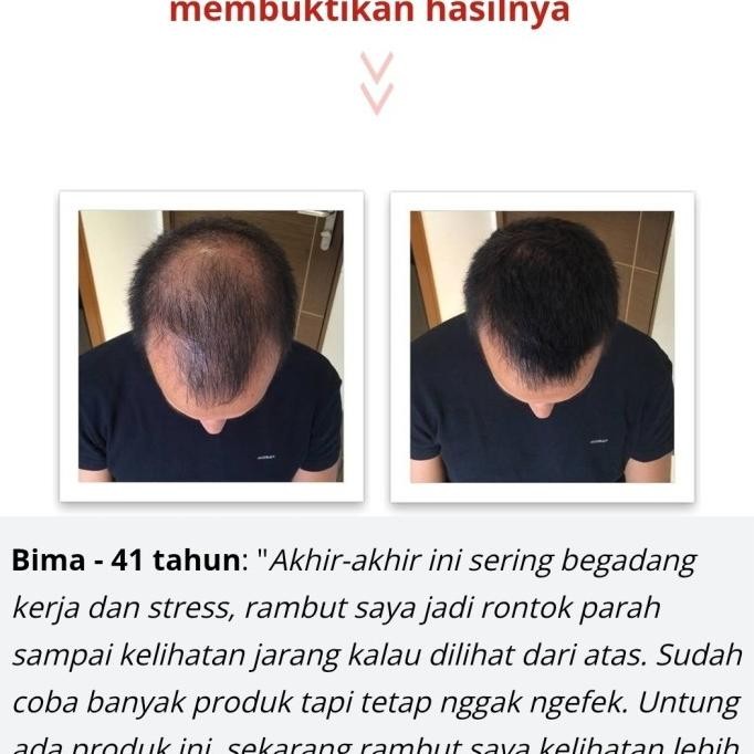 TERMURAH - Hair Growth DHT Blocker Serum & Shampoo Penumbuh Rambut Herbal Alami