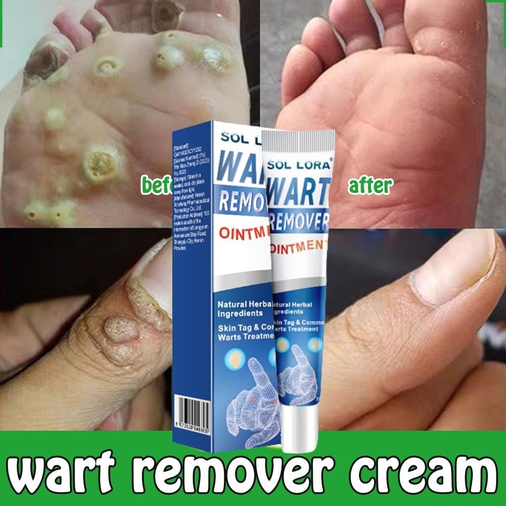 Sumifun Wart Removal Skin Tag Penghilang Kutil Wart Remover Ointment