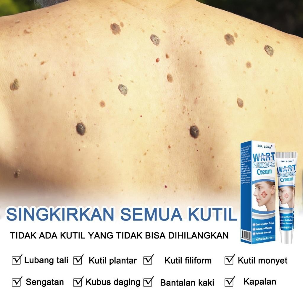 Cod -Efek Bagus Obat Kutil Paling Ampuh Oles Penghilang Kutil 20G Manjur Tanpa Operasi Mahal Penghap