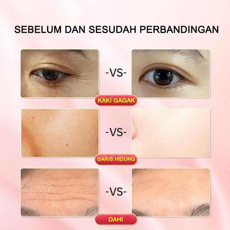 Dan Kulit Seperti Bayi Moyika Krim Wajah Anti Whitening Mengurangi Lingkaran Hitam Keriput Anti Penu