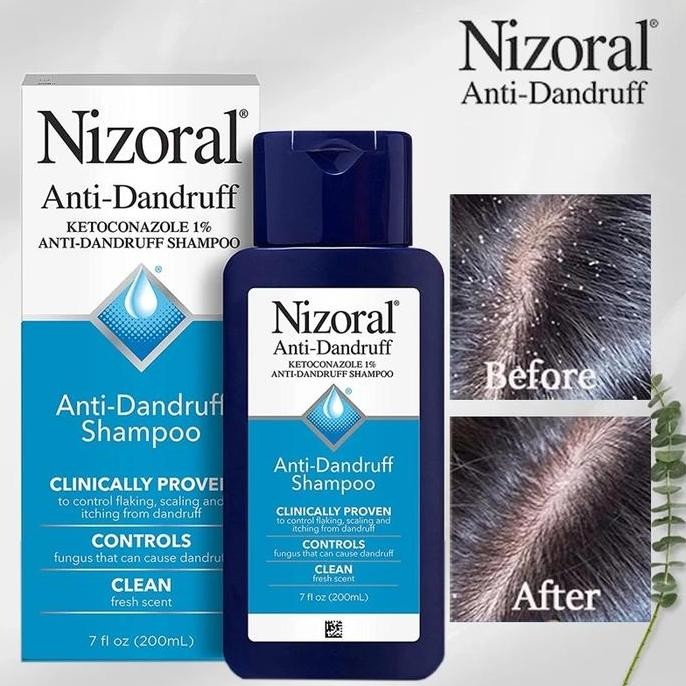 TERLARIS - Nizoral Anti Dandruff Shampoo Ketombe 1% Ketoconazole 200ml ORIGINAL USA