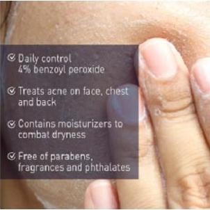 Panoxyl Creamy Acne Wash 4% 10% Benzoyl Peroxide Face Cleanser