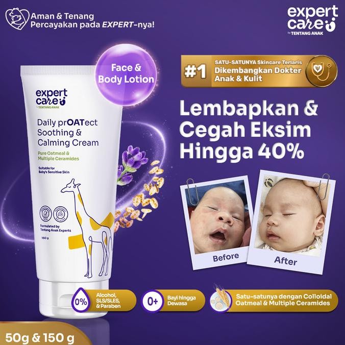 Promo Expert Care Moisturizer Lotion Bayi Colloidal Oatmeal Ceramide
