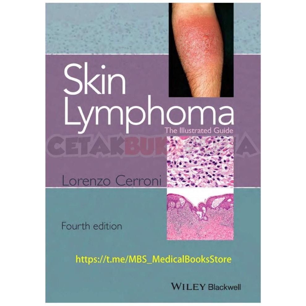 Book Skin Lymphoma Illustrated Guide Softcover