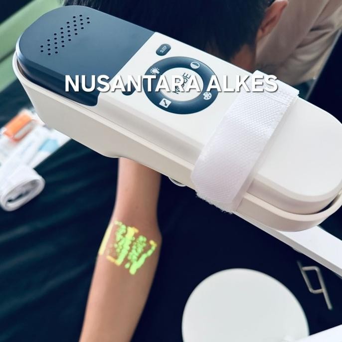 Alat Pencari Vena / Vein Finder / Vein Illuminator / Vena Viewer Ber Co