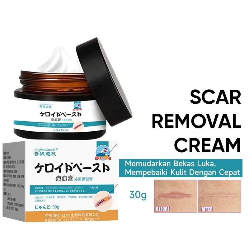 Penghilang Bekas Luka Hitam Koreng Salep Penghilang Bekas Luka Obat Penghilang Bekas Luka Menghilang