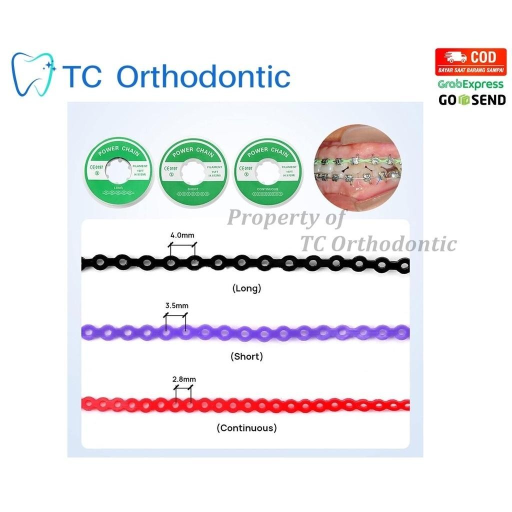 Karet Power Chain Behel Gigi Warna Hitam Isi 5 Pcs / Power Chains For Braces / Karet Tarik Behel