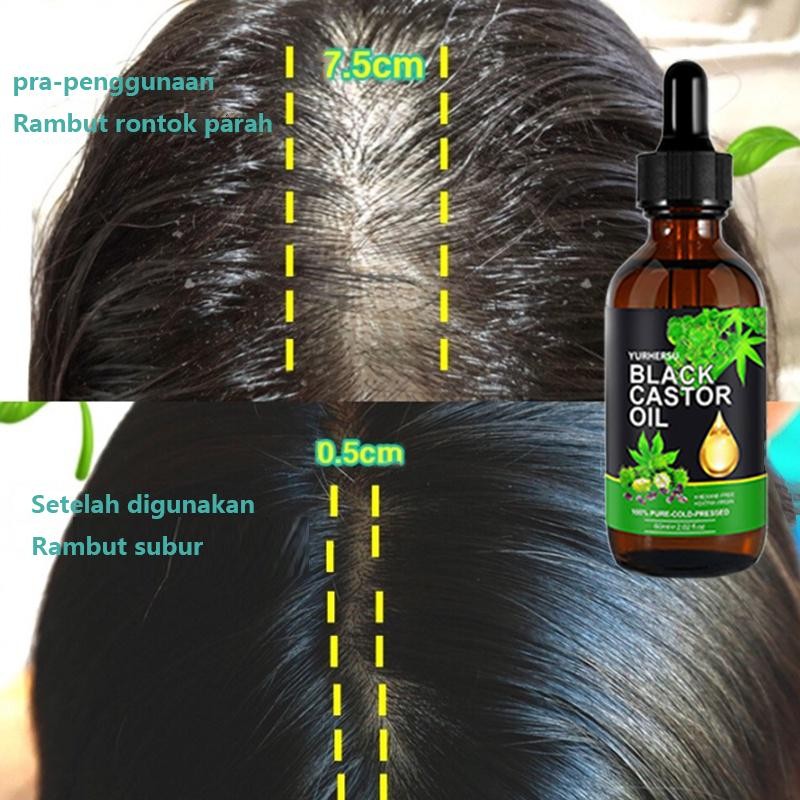 Serum Penumbuh Rambut Cepat Hair Growth Serum Penumbuh Rambut Botak Obat Penumbuh Rambut Botak Penum