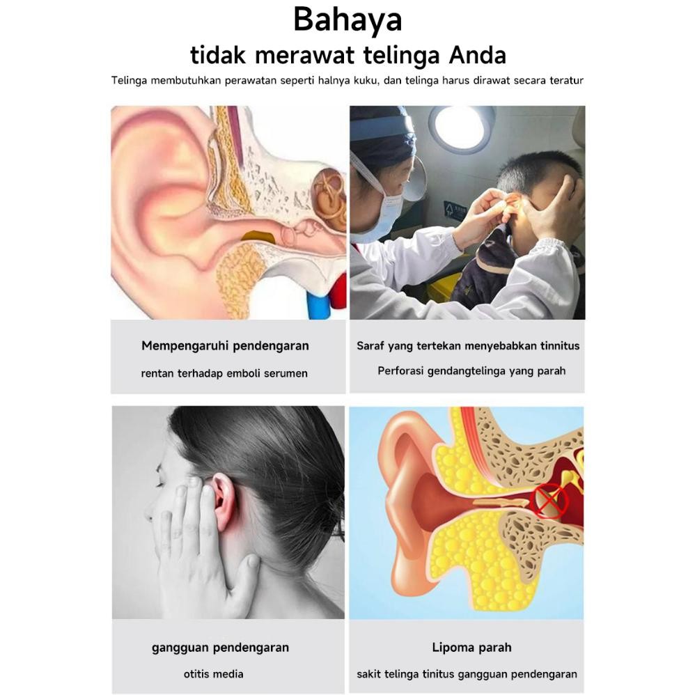 Promo Pembersih Telinga Bayi Korek Kuping Led Kamera Wifi Hp Korek Kuping Bayi Pembersih Kuping Smar