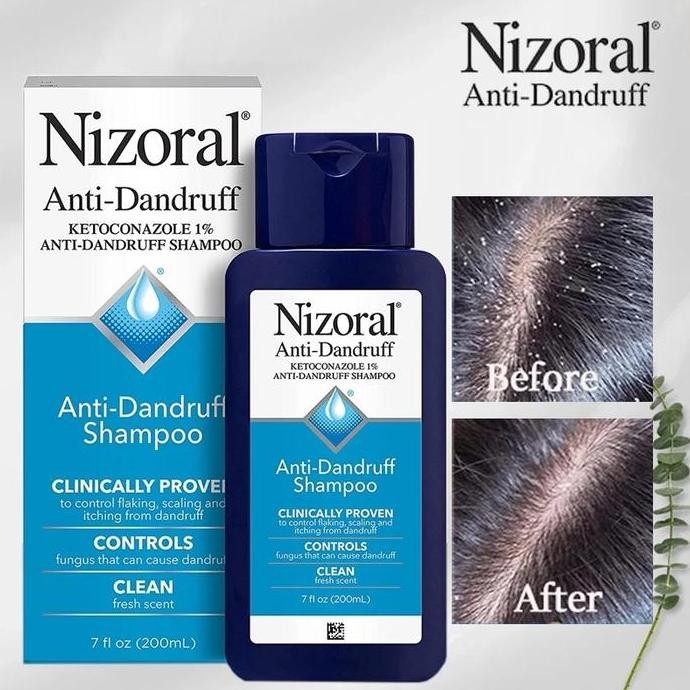 BEBAS ONGKIR - Nizoral Anti Dandruff Shampoo Ketombe 1% Ketoconazole 200ml ORIGINAL USA