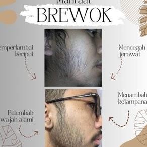 PROMO / Minoxidil Original Labbol - Penumbuh Rambut Dan Brewok Minoxidil 5% dan 10% NON COD