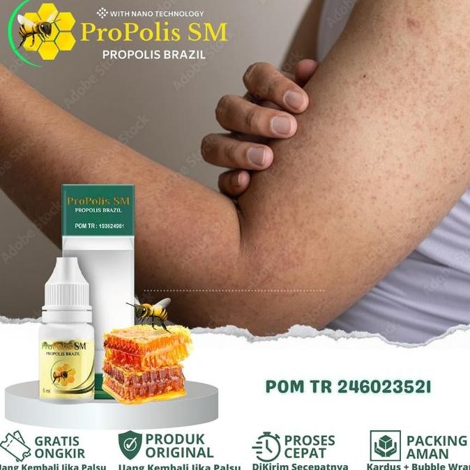 

READY KERATOSIS PILARIS - BINTIK HITAM DI KULIT - KERING DAN KASAR - PENYAKIT KULIT AYAM - PROPOLIS SM