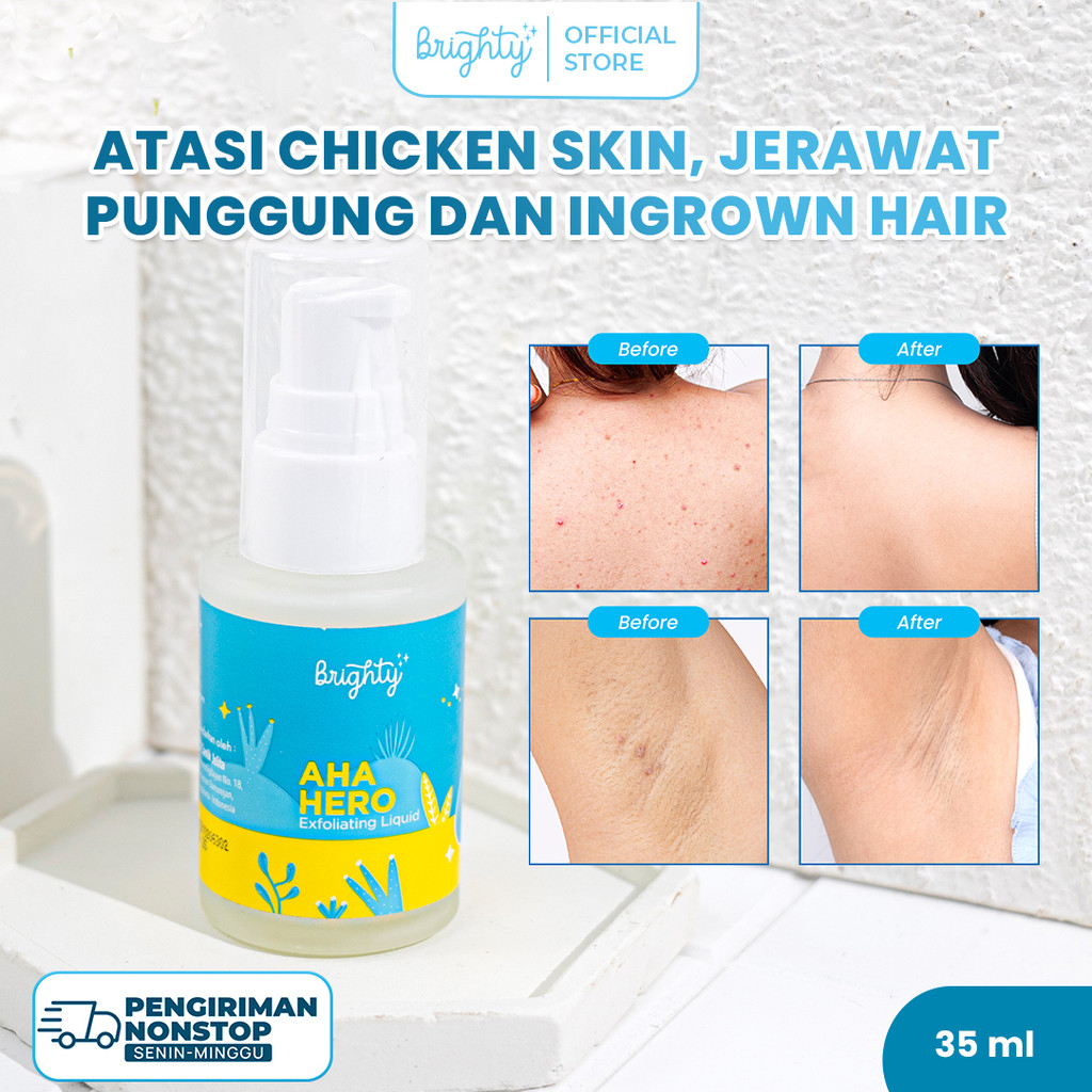 Brighty Aha Hero Exfoliating Liquid Serum Mencerahkan Kulit Dan Menghilangkan Ingrown Hair