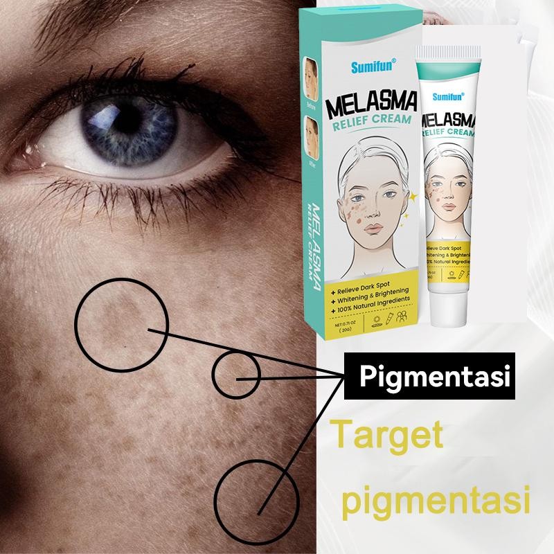Cream Flek Hitam Membandel Serum Penghilang Flek Hitam Whitening And Freckle Removal 20G Whitening A
