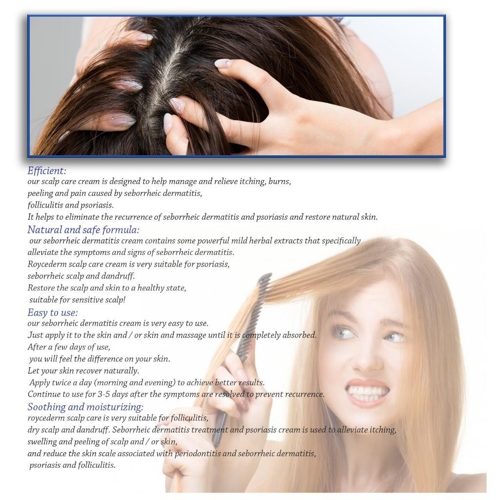 South Moon Seborrheic Dermatitis Cream 50G Seborrheic Skin Cream Krim Obat Kulit Kepala Psoriasis Ob