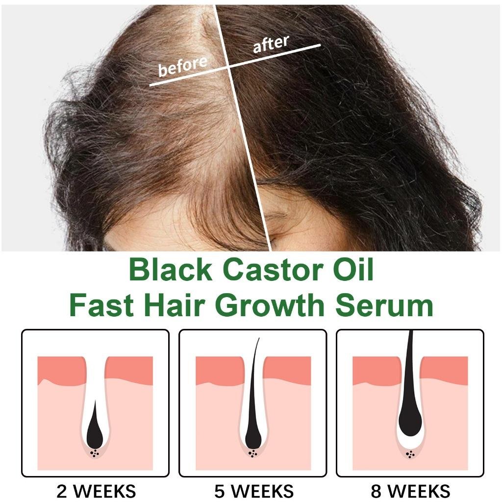 Jaysuing Castor Oil 60Ml Penumbuh Rambut Cepat Dan Tebal Penumbuh Rambut Botak Hair Growth Serum Cod