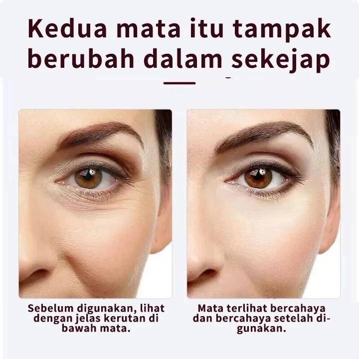 Krim Mata Racun Ular 15G Anti-Bengkak Kerutan Perawatan Lingkaran Hitam Pelembab Wajah Anti-Penuaan 