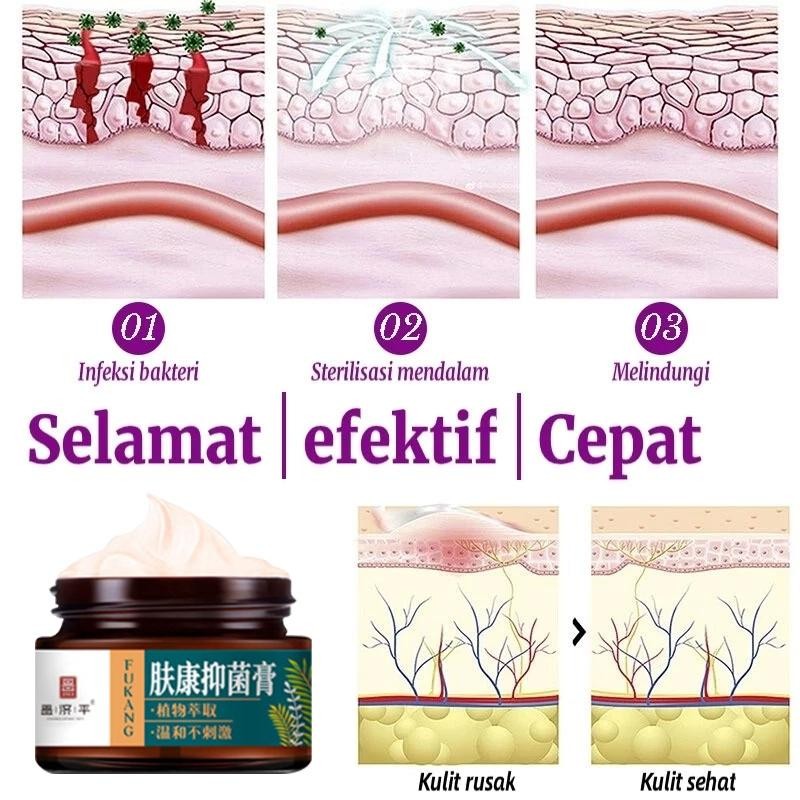 Salep Gatal Paling Ampuh 30G Ampuh Obat Gatal Kulit Eksim Psoriasis Jamur Panu Paling  Salap Gatal K